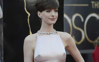 Anne Hathaway se disculpa por el vestido que lució en los Oscar